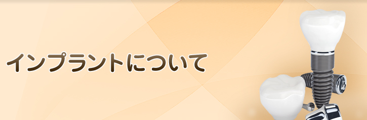 インプラントについて